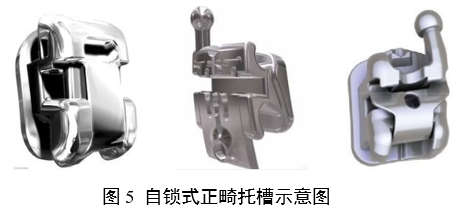 正畸托槽注冊(cè)審查指導(dǎo)原則（2022年第41號(hào)）(圖5)