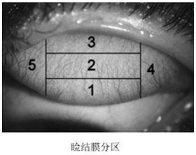 接觸鏡護理產品注冊審查指導原則（2023年修訂版）（2023年第9號）(圖7)