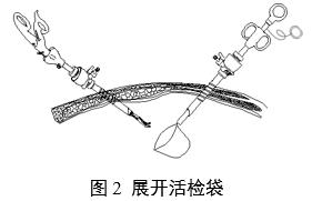 一次性使用內(nèi)窺鏡用活檢袋注冊審查指導(dǎo)原則（2025年第20號）(圖2)