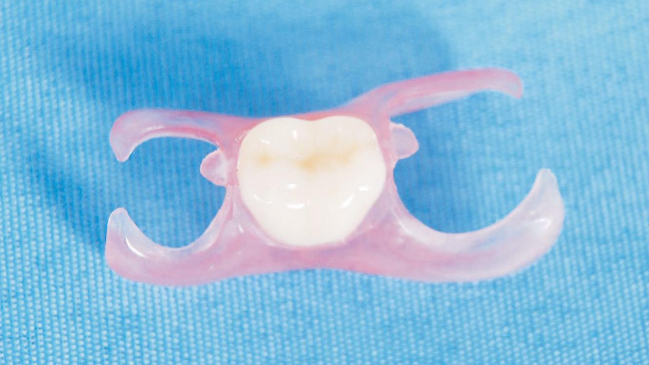 定制式義齒注冊技術(shù)審查指導原則（2018年修訂）（2018年第80號）(圖1)